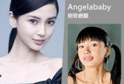 成都整容爆料案件最新,揭开医美行业潜规则与维权困境