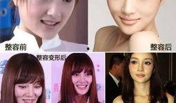 成都整容爆料案件最新,揭开医美行业潜规则与维权困境